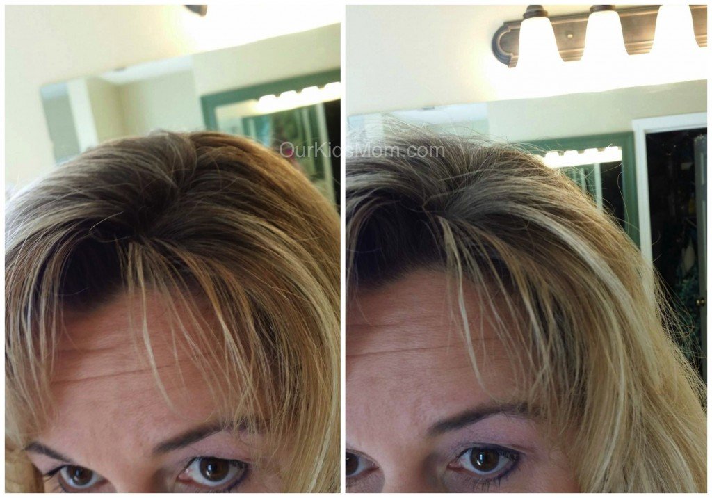 Before & After