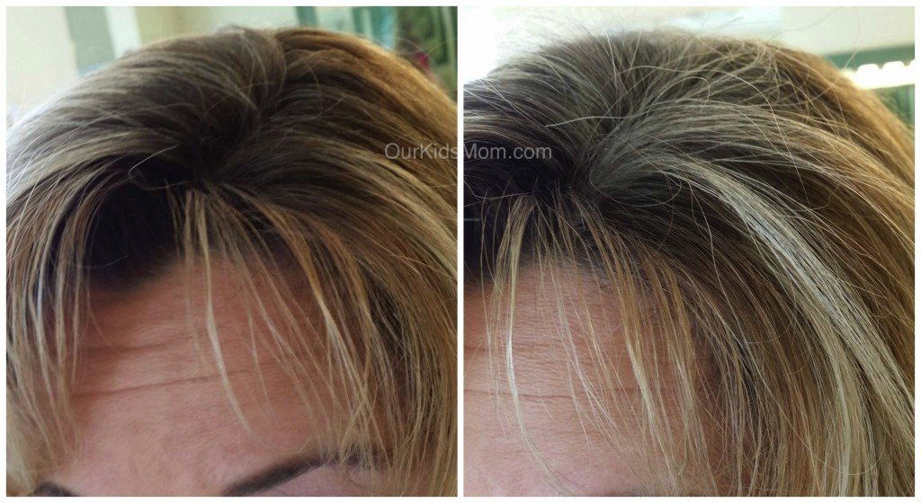 Before & After Side